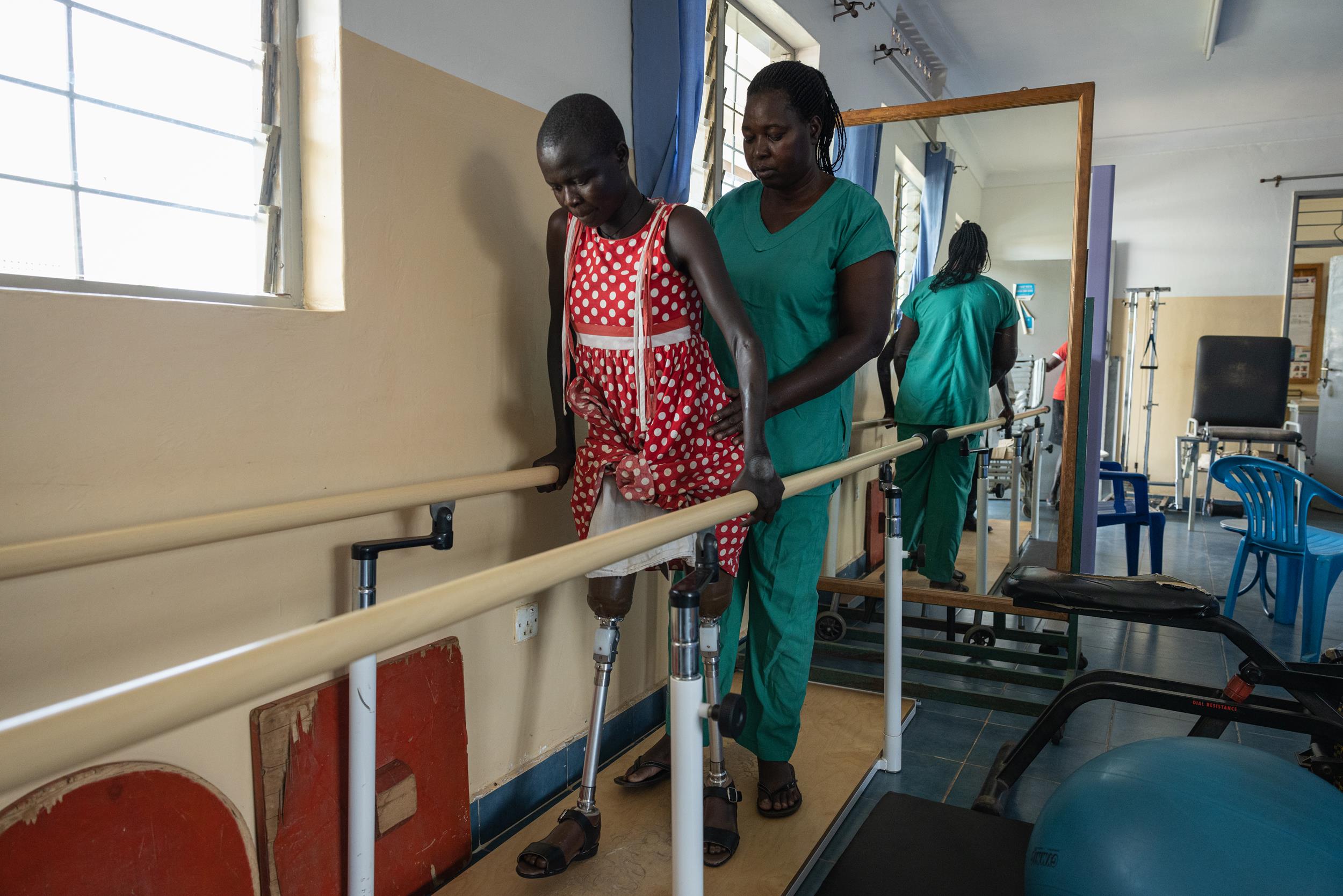 Akello Linda, doing physiotherapy to learn to use the prosthetic legs